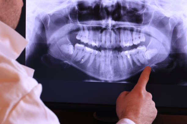 Best Dental Abscess Treatment in Old Brookville, NY